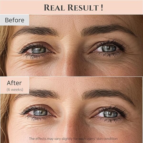 Beauty of Joseon Revive Eye Serum with Retinal Niacinamide Correction for Puffy Eye - Image 2